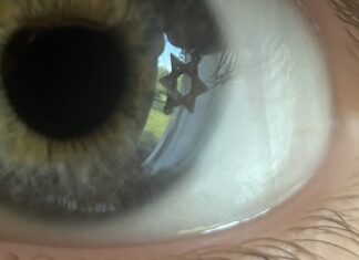 A close up of a blue eye with a Jewish star reflecting in the iris.